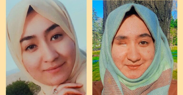 Afghan Student Determined to Advocate for Change After Losing Eye in Terror Attack
