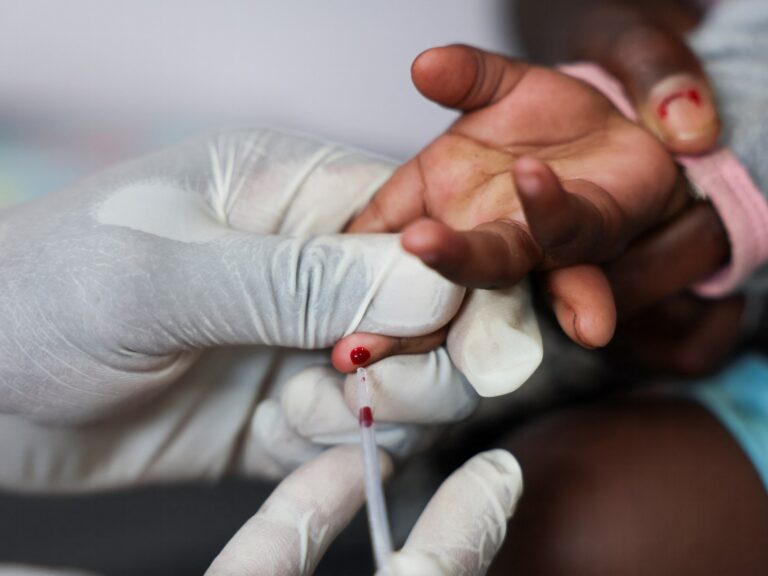 UN warns that US aid cuts may result in millions more HIV/AIDS deaths by 2029