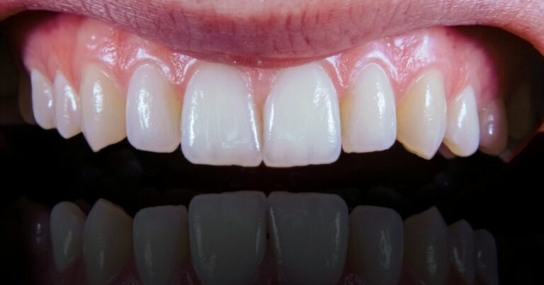 Study Finds Mediterranean Diet Associated with Healthier Gums
