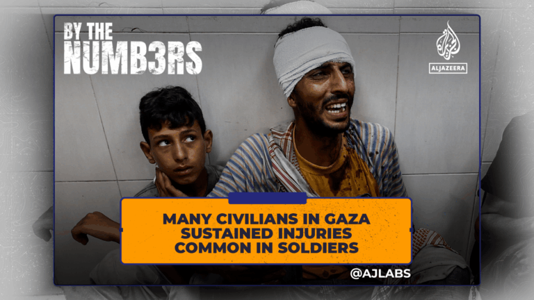 Numerous civilians in Gaza suffered injuries typical of soldiers