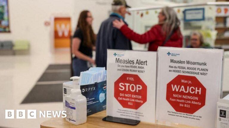 Canada no longer considered measles-free, US may be next
