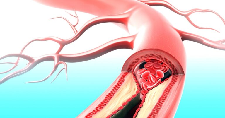 Addressing Diabetes and Heart Disease through a Two-Pronged Approach